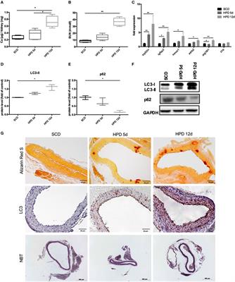 Autophagy Protects From Uremic Vascular Media Calcification